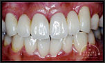 歯周病技術＋審美技術＋複合治療