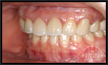 咬合治療を中心としたインプラント技術・審美歯科・歯周病治療