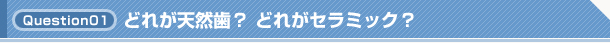 Q1. どれが天然歯？ どれがセラミック？