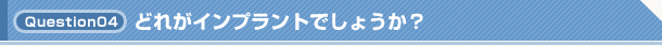 Q4.どれがインプラントでしょうか？