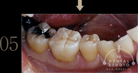 05.施後3ヶ月写真