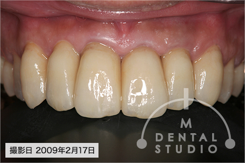 施術後写真(正面)