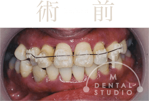 術前写真(正面)