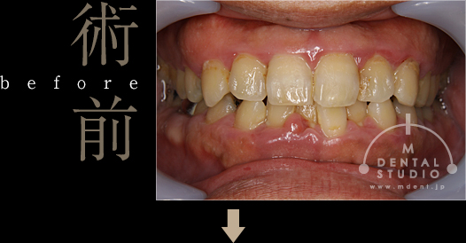 施術前写真(正面)