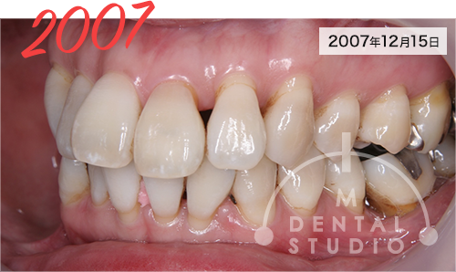 2007年12月15日 写真