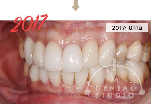 2017年8月1日 写真