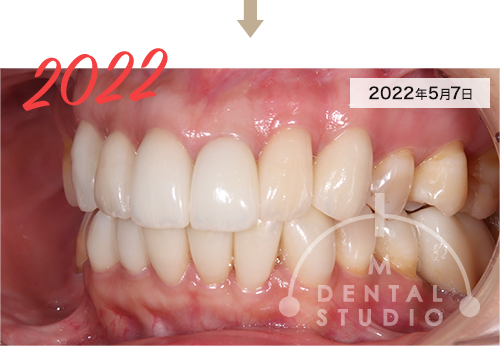 2022年5月7日 写真