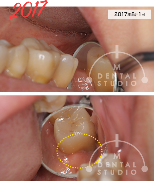 術前写真(左側)