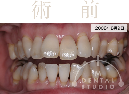 2008年8月9日 写真