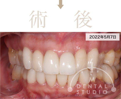 2022年5月7日 写真