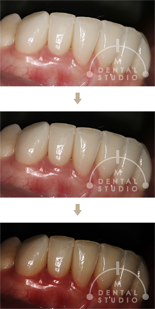 明るさを変えた写真