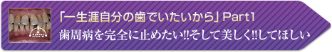 「一生涯自分の歯でいたいから」Part2 (歯周病を完全に止めたい！そして美しく！してほしいPart1)