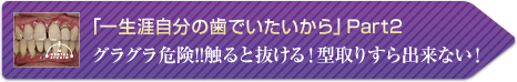 「一生涯自分の歯でいたいから」Part2 (グラグラ危険!!触ると抜ける！型取りすら出来ない！)