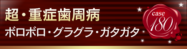 超・重症歯周病(No.180)ボロボロ・グラグラ・ガタガタ