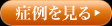 重度歯周病の完治例