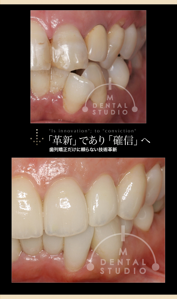 「革新」であり「確信」へ 歯列矯正だけに頼らない技術革新