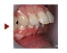 出っ歯を治したい！！partⅡ（34歳女性）