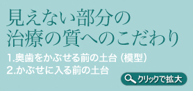 見えない部分の治療の質へのこだわり