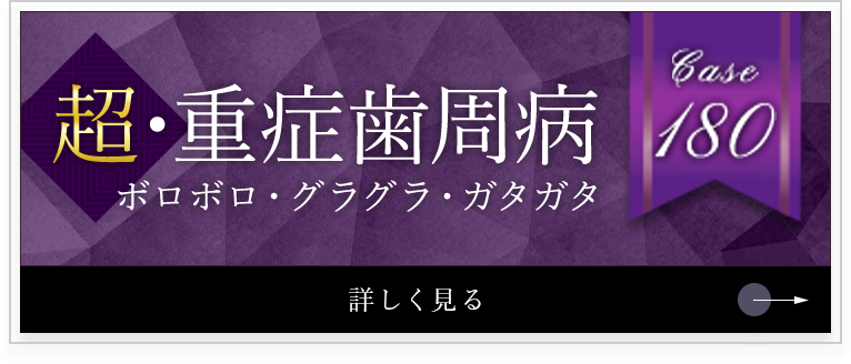 超・重症歯周病　ボロボロ・グラグラ・ガタガタ