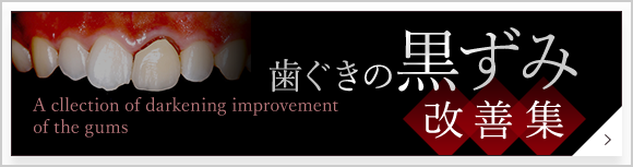 歯ぐきの黒ずみ　改善集