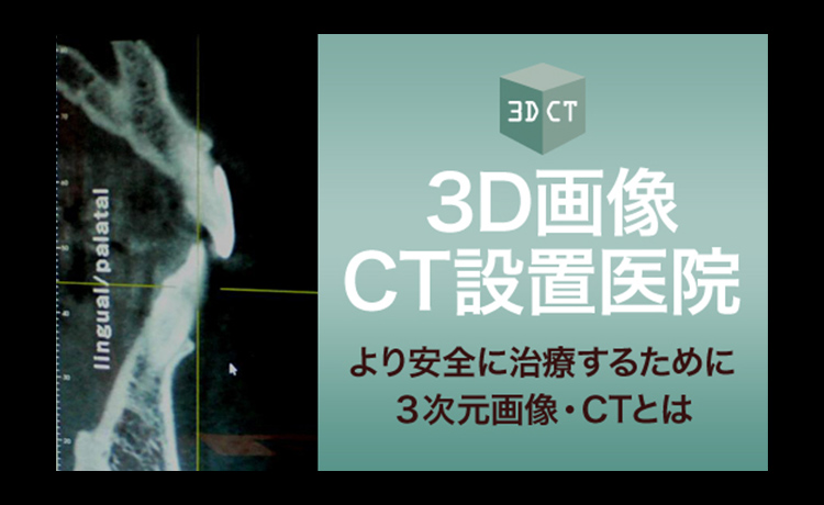 3D画像　CT設置医院　より安全に治療するために3次元画像・CTとは