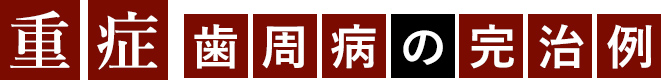 重症歯周病の完治例